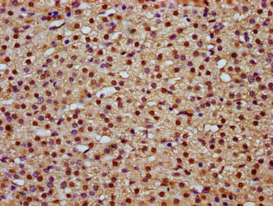 Polyclonal Rabbit anti-Human MAML2 Antibody (IHC, WB)
