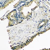 ETFA Antibody