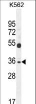 SULT1C3 / Sulfotransferase 1C3 Antibody (aa264-292)