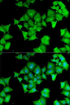Polyclonal Rabbit anti-Human ACY1 / Aminoacylase 1 Antibody (IHC, IF, WB)