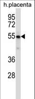 Polyclonal Rabbit anti-Mouse YES1 / c-Yes Antibody (aa1-30, WB)