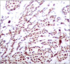 Polyclonal Rabbit anti-Human ATF2 Antibody (IHC, IF, WB)