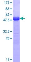 Human SCML1 Protein (Recombinant GST)