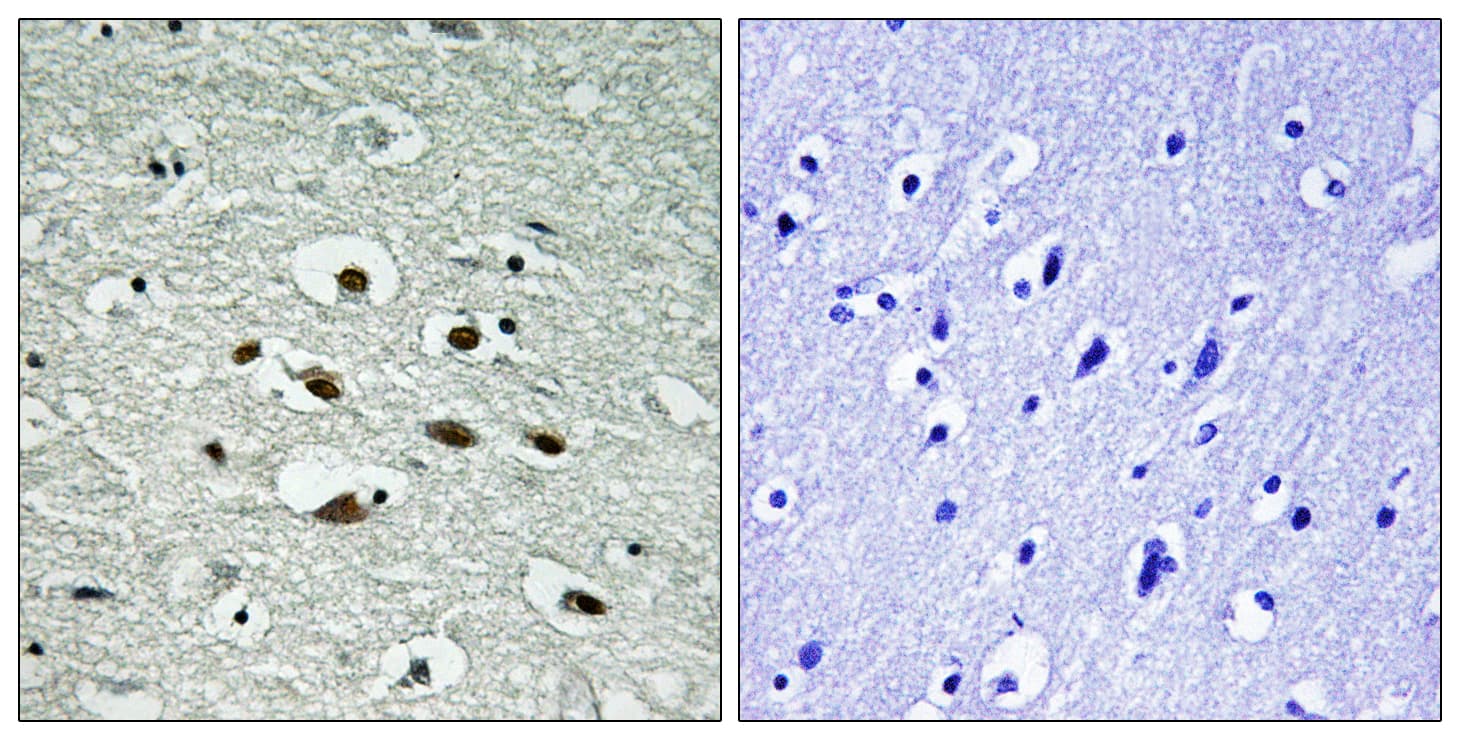 CHEK1 / CHK1 Antibody (phospho-Ser296)