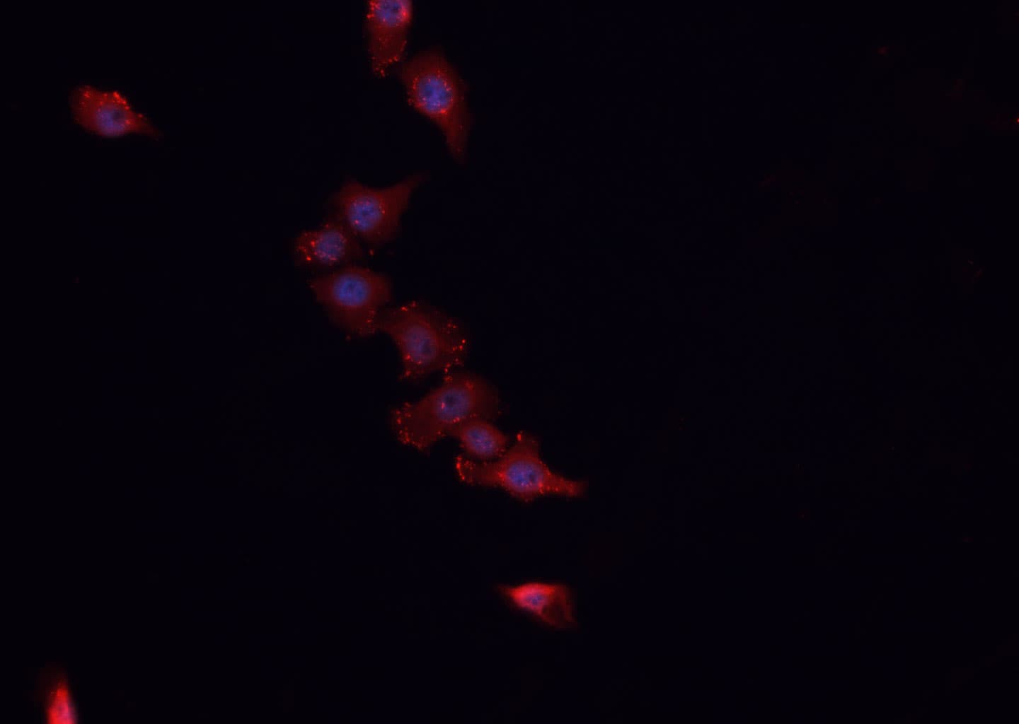 HSPE1 / HSP10 / Chaperonin 10 Antibody