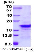 Human RPL26L1 Protein (Recombinant His)