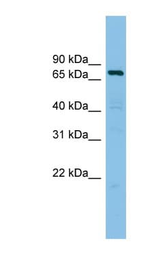 Polyclonal Rabbit anti-Human AKAP10 Antibody (aa575-624, WB)