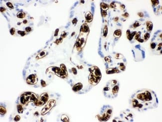 Polyclonal Rabbit anti-Human SLC4A1 / Band 3 / AE1 Antibody (aa28-365, IHC, WB)