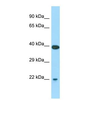 Polyclonal Rabbit anti-Mouse SARA2 / SAR1B Antibody (C-Terminus, WB)