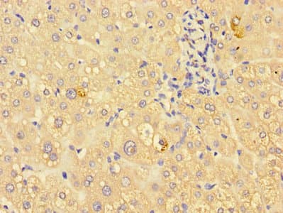 Polyclonal Rabbit anti-Human ING3 Antibody (IHC, WB)
