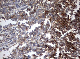 CD99 Antibody (clone OTI13F10)