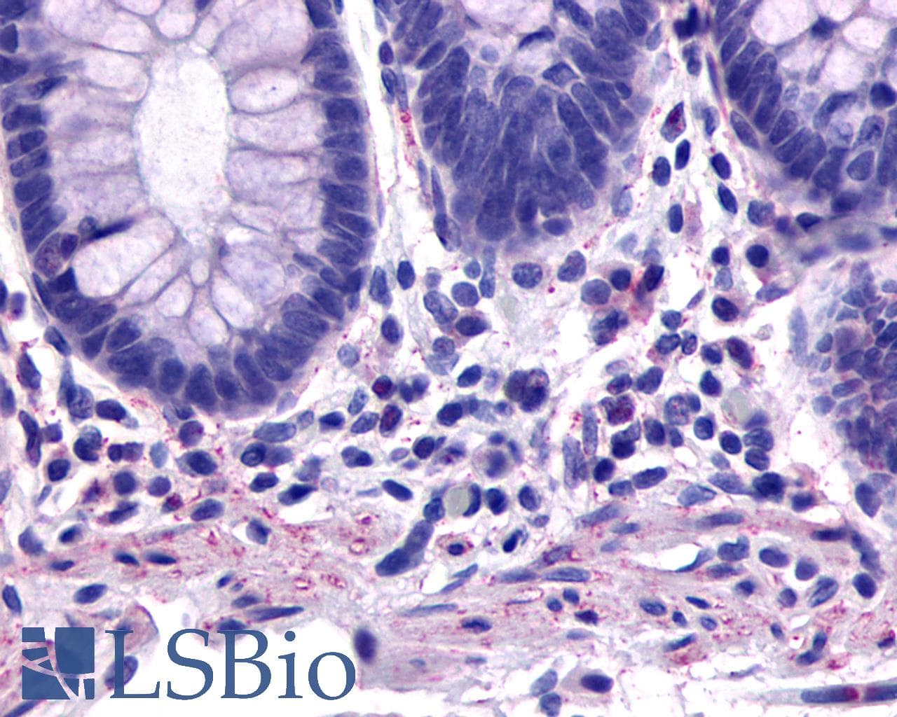 PathPlus™ TACR2 / NK2R Antibody (C-Terminus)