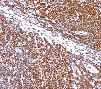SUMO1 / SMT3 Antibody (clone S1MT-2)