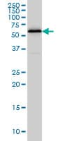 IHC-plus™ HDAC1 Antibody (clone 5A11)