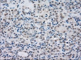 SATB1 Antibody (clone OTI13D6)