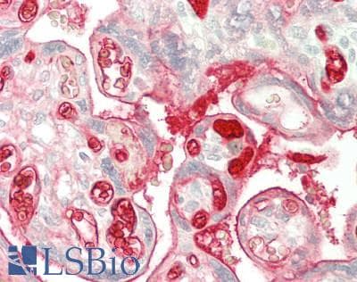 IHC-plus™ CFH / Complement Factor H Antibody