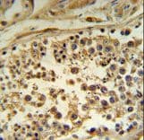HFE Antibody (aa122-148)