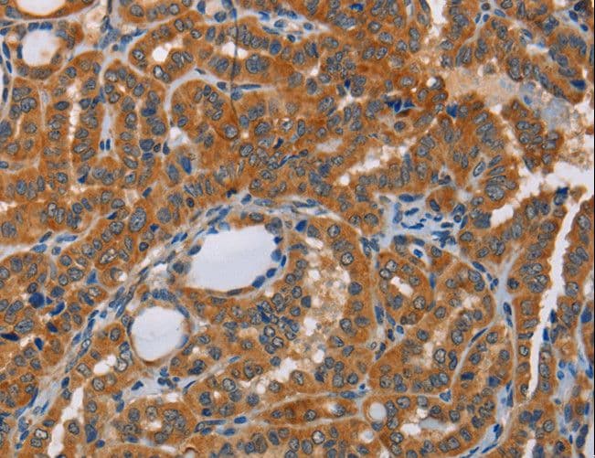 KRT13 / CK13 / Cytokeratin 13 Antibody