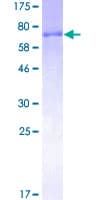 Human ZRP-1 / TRIP6 Protein (Recombinant GST)