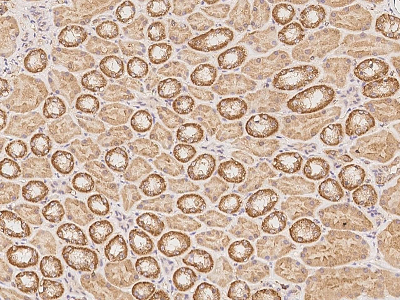 PDPR Antibody