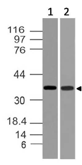 TWISTNB Antibody
