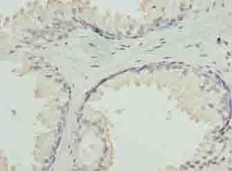 GNA14 Antibody