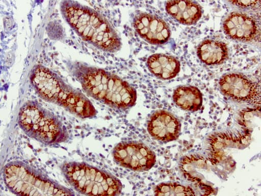 Monoclonal Mouse anti-Human SQSTM1 Antibody (clone UMAB12, Carrier-free, IHC, IF, WB)
