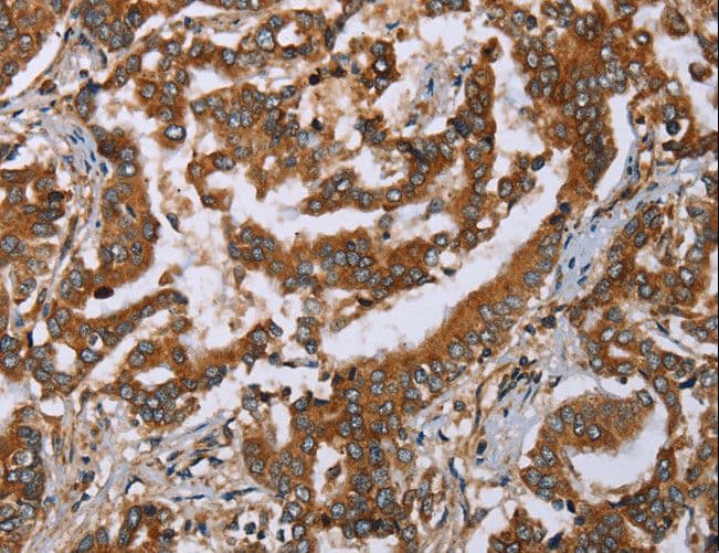 IHC-plus™ Polyclonal Rabbit anti-Human PLXNB1 / Plexin-B1 Antibody (IHC)