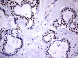Monoclonal Mouse anti-Human FOXP1 Antibody (clone OTI3G3, IHC)