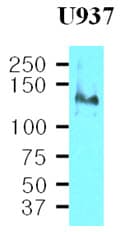 IHC-plus™ Monoclonal Mouse anti-Human ITGB1 / Integrin Beta 1 / CD29 Antibody (clone K2D5, aa34-141, IHC, WB)