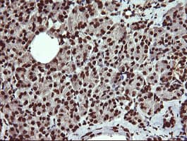 DNM1L / DRP1 Antibody (clone OTI2E7)