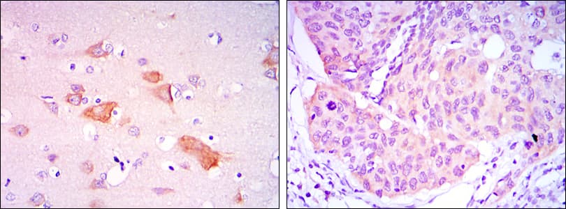 SMAD5 Antibody (clone 3H9)