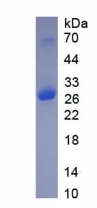 Mouse PCK1 Protein (Recombinant His-T7)