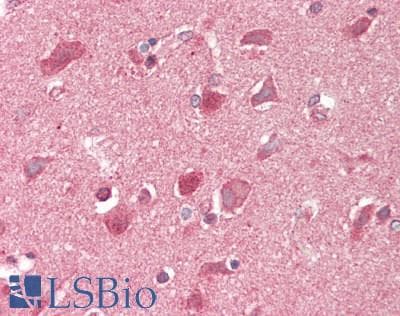 IHC-plus™ Polyclonal Rabbit anti-Human GRID1 Antibody (aa811-860, IHC, WB)