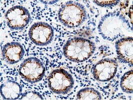 Monoclonal Mouse anti-Human CD80 Antibody (clone OTI2E5, IHC, IF, WB)