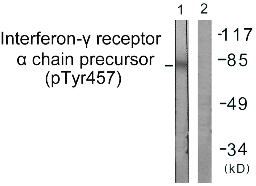 CD119 / IFNGR1 Antibody (phospho-Tyr457)
