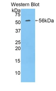 RPN1 / Ribophorin I Antibody (aa273-518)