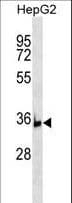 BRIX1 Antibody (aa257-285)