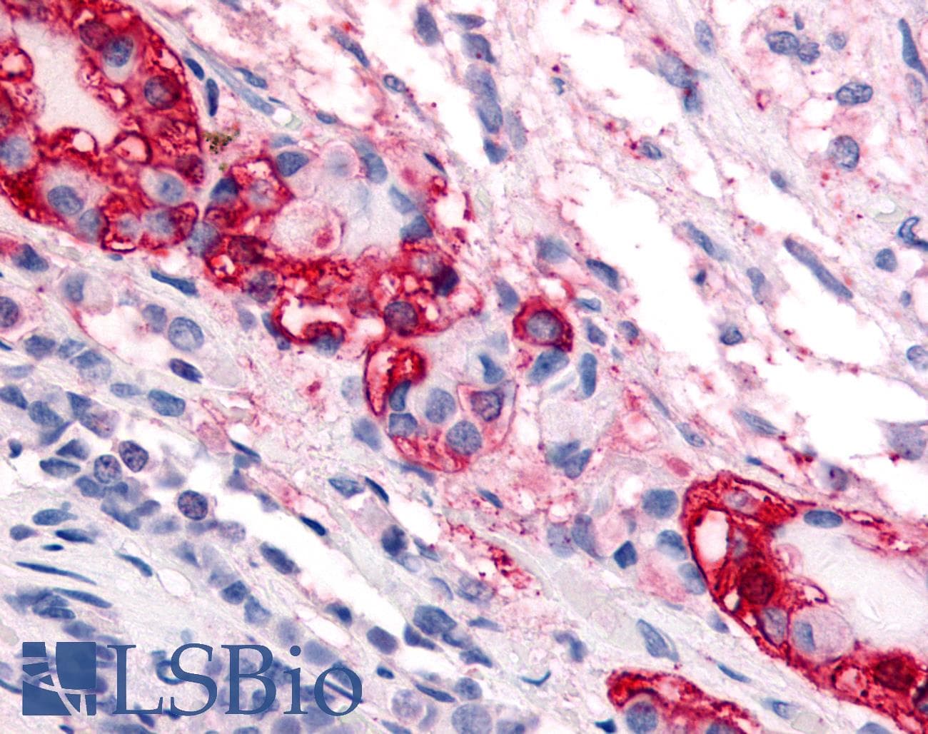 PathPlus™ Polyclonal Rabbit anti-Human CRFR1 / CRHR1 Antibody (N-Terminus, IHC)