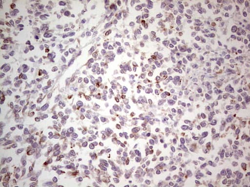 Monoclonal Mouse anti-Human NEFM / NF-M Antibody (clone OTI2G3, aa413-773, IHC, WB)