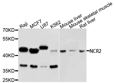Polyclonal Rabbit anti-Human NCR2 / NKP44 Antibody (IHC, WB)
