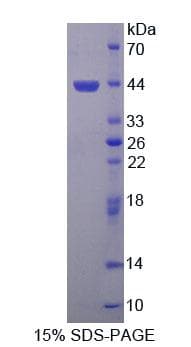 Human SYMPK / Symplekin Protein (Recombinant His-T7)