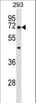 NR5A2 / LRH-1 Antibody (aa314-342)