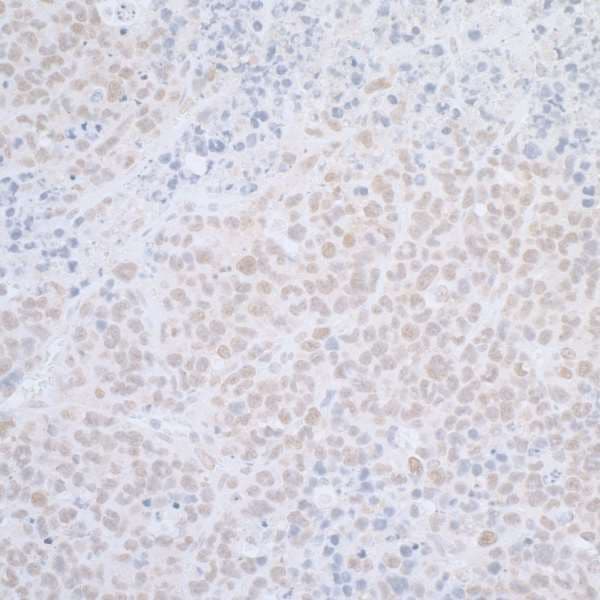 Polyclonal Rabbit anti-Human ELAC2 Antibody (aa776-826, IHC, WB)