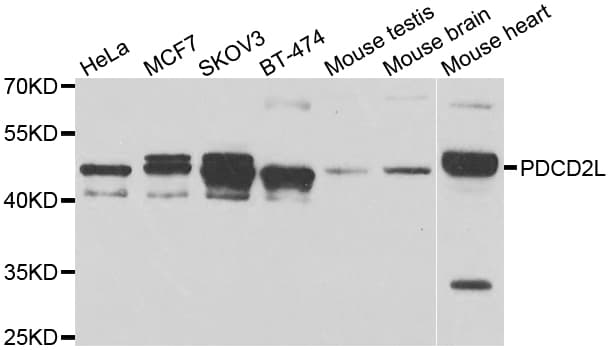 PDCD2L Antibody