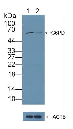 G6PD Antibody (aa1-515)
