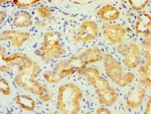 FKBP4 / FKBP52 Antibody (aa220-459)
