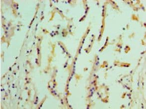EPHX1 / Epoxide Hydrolase 1 Antibody (aa1-455)