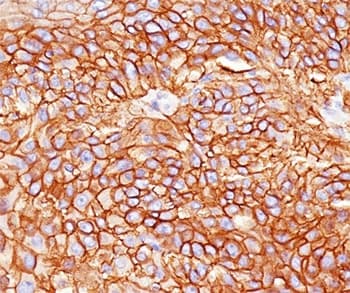 Monoclonal Mouse anti-Human EGFR Antibody (clone GFR450, Azide-free,BSA-free, IHC, IF)
