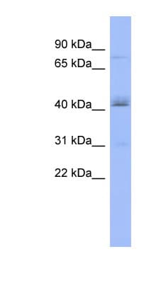 PAPOLB Antibody (aa431-480)
